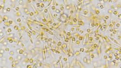 Photo of marine diatoms to illustrate ocean microbe biodiversity for a Frontiers in Science article on the KMAP Global Ocean Gene Catalog 